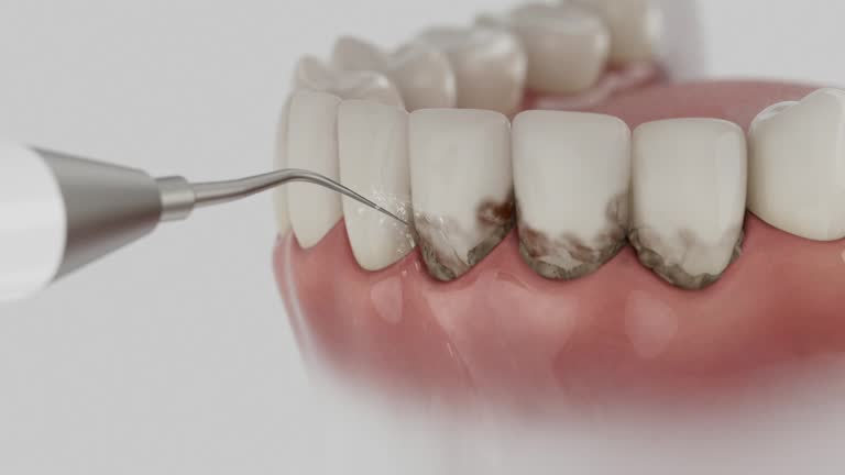 Reliable Dental contractor in Rouse, CA by Smile Center Dentistry